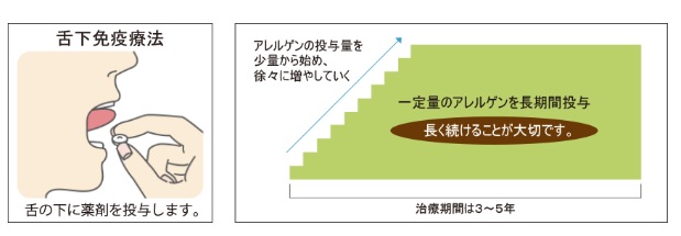 舌下免疫療法