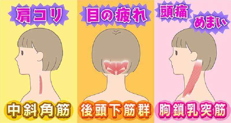 【NHK・あさイチ】首のストレッチで首の痛み解消方法！首の筋肉攻略法とは？