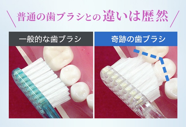 なぞるだけで汚れが落ちる歯ブラシサブスク「奇跡の歯ブラシ」
