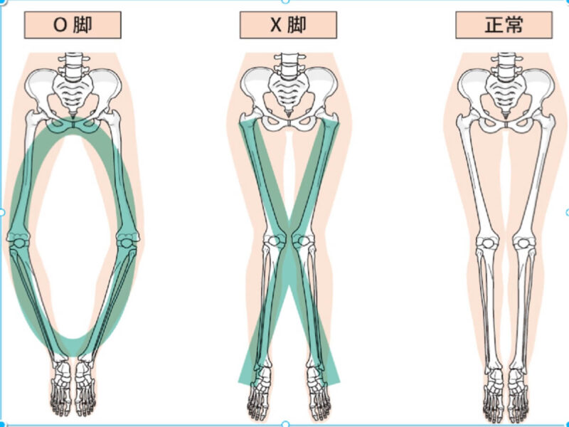 NHK【あさイチ】“股関節ケア”大特集！垂れ尻やＯ脚などを改善する方法とは？