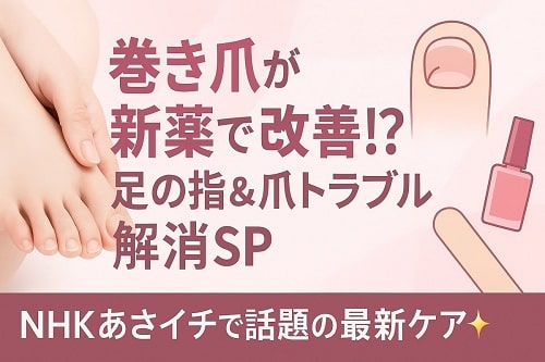 【あさイチ】自宅でできる爪ケア＆最新治療法の画像