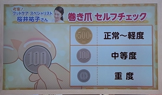 引用【あさイチ】巻き爪セルフチェック