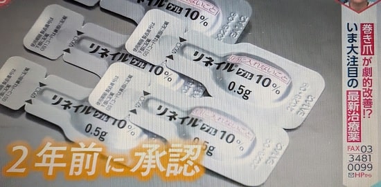 引用【あさイチ】巻き爪治療薬「リネマイル」